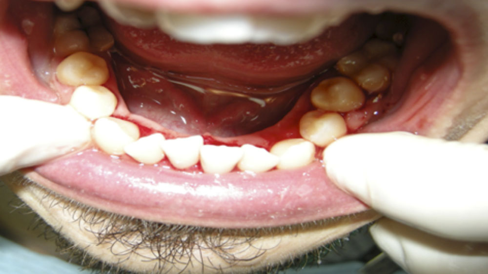 After-PERIODONCIA